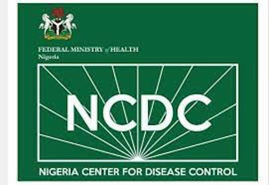 NCDC Launches Advanced Diagnostic Laboratory, Says It’ll Improve Testing Standard