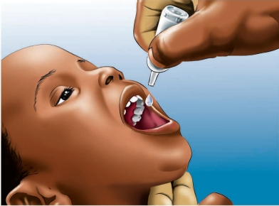 THE CHALLENGE OF ROUTINE IMMUNISATION